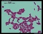 Enterobacter cloacae microscopy